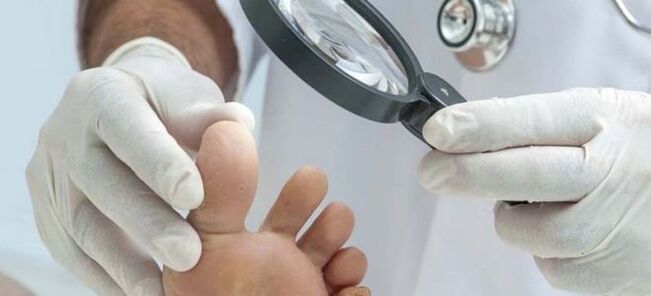 Exámenes antes de iniciar el tratamiento fúngico.