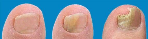 Proceso de desarrollo de hongos.