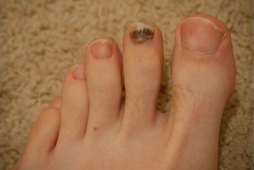 Uso de medicamentos orales y tópicos.