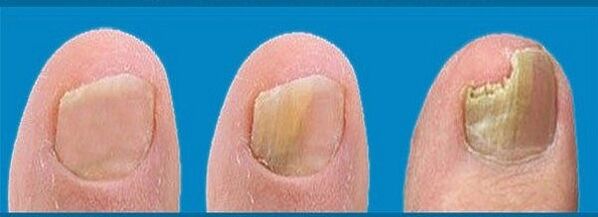 Proceso de desarrollo de hongos.