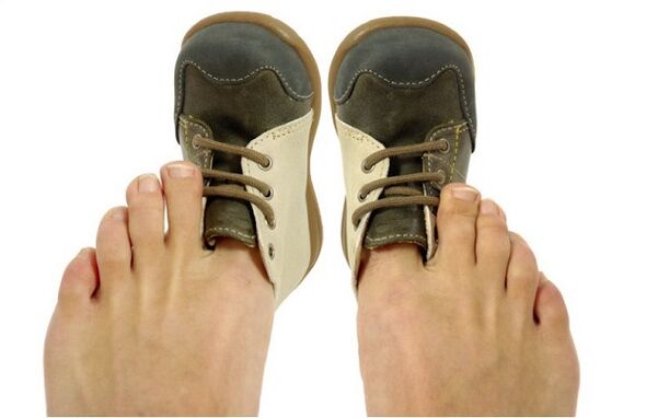 Cómo reconocer los hongos en las uñas de los pies por los síntomas